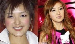 明星爆料整容视频播放,整容视频曝光引发热议